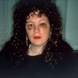 <p><b>Nan Goldin</b>, <i>Nan One Month After Being Battered</i>, 1984.</p>