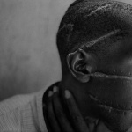 <p><b>James Natchwey</b>, <i>Rwanda, 1994 - Survivor of Hutu death camp.</i></p>