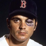 <p><b>Neil Leifer</b>, <i>Closeup portrait of Boston Red Sox outfielder Tony Conigliaro with black eye, simulating an injury after getting hit by a ball. 5/25/1970.</i></p>